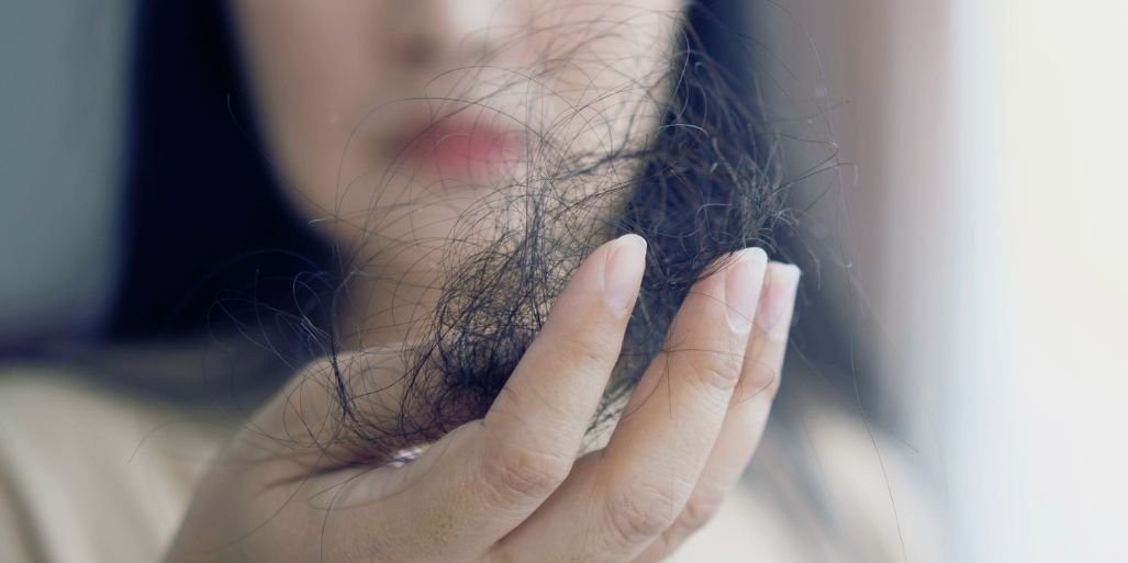 Ménopause et chute des cheveux
